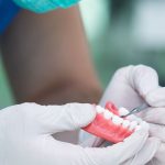 Est-il possible d'avoir une prothèse dentaire sans reste à charge ?